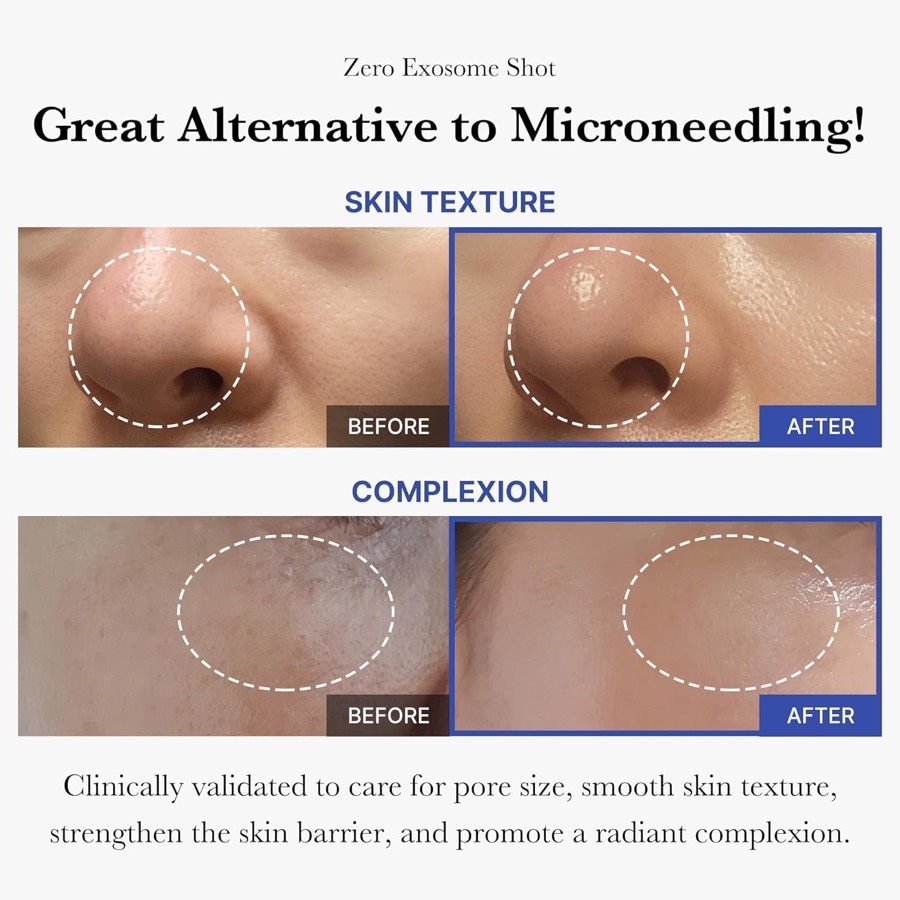 MEDICUBE Zero Pore Peel Shot additional product photograph 3