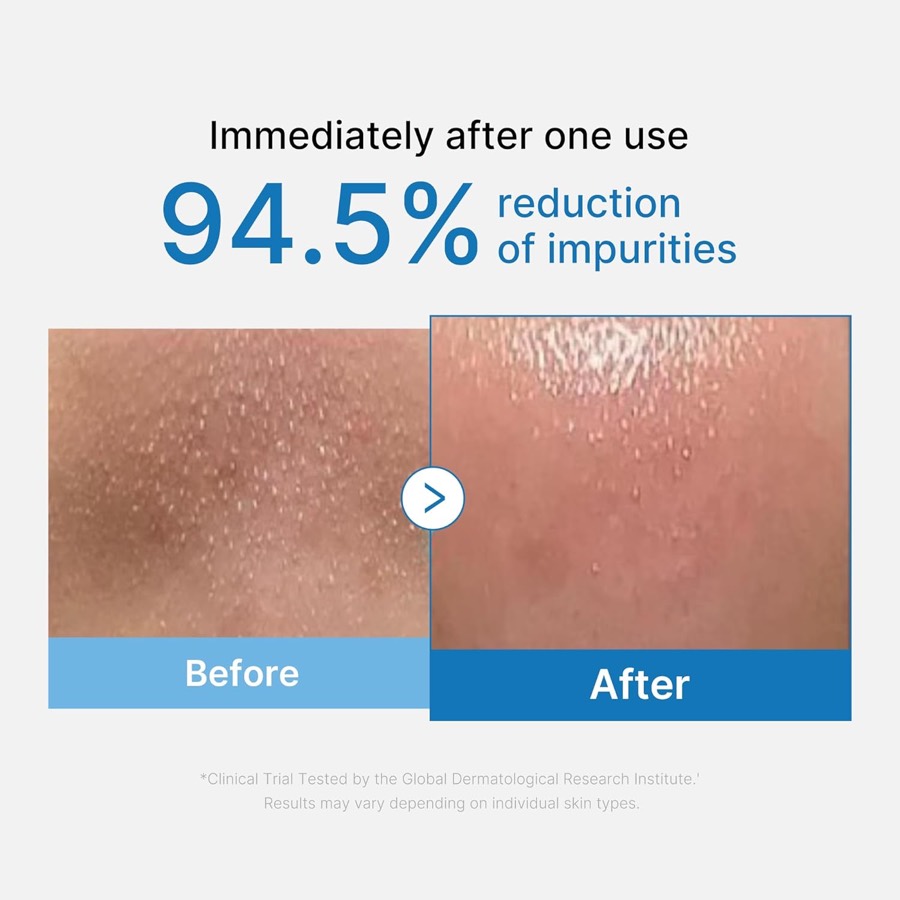 MEDICUBE Zero Pore Blackhead Cleansing Oil additional product photograph 2