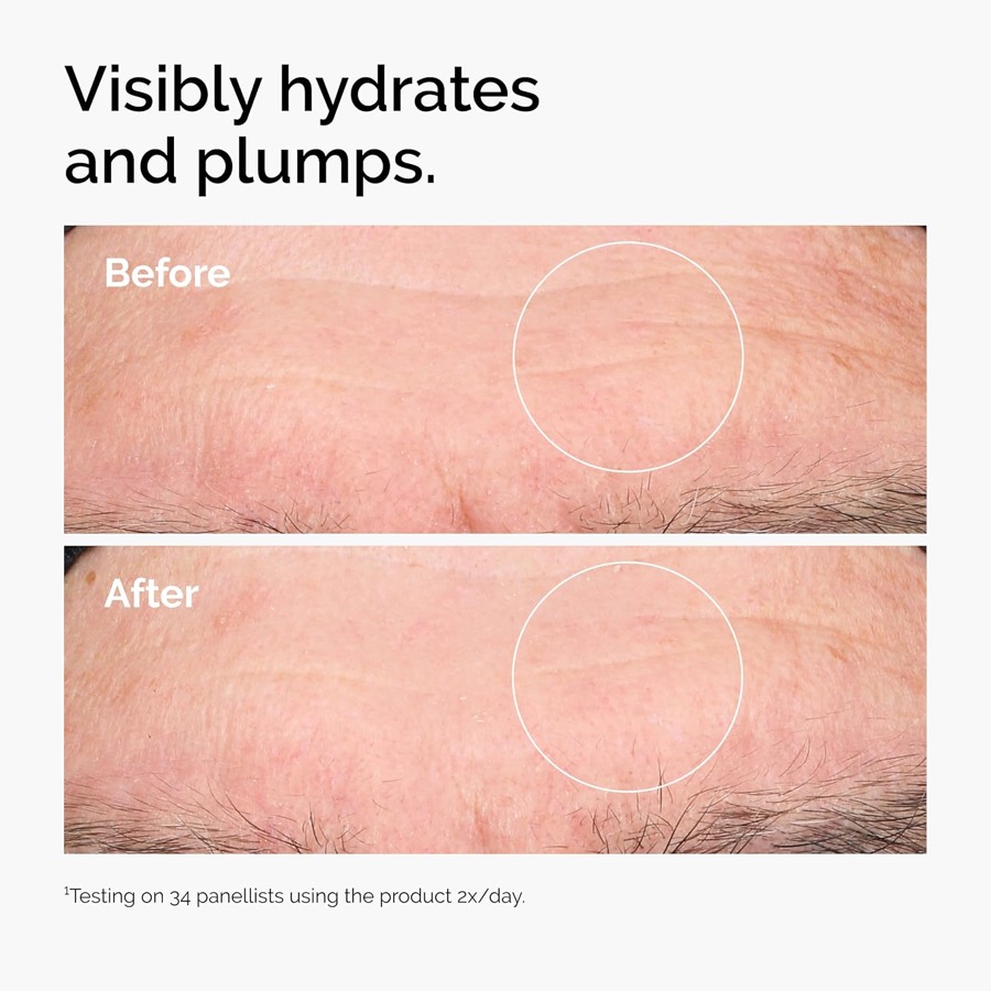 THE ORDINARY Hyaluronic Acid 2% + B5 additional product photograph 2